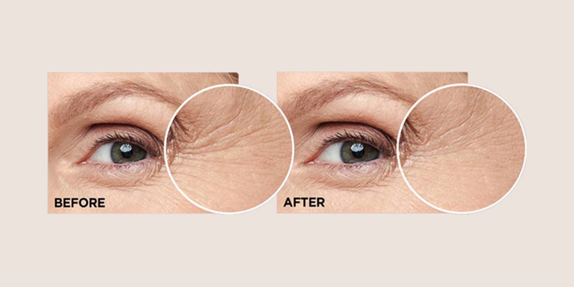 Inarticle How To Conceal Under Eye Bags CaffeineEyeSerum